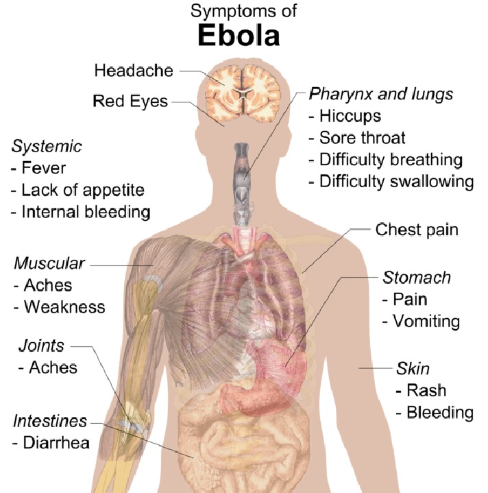 Ebola Symptoms